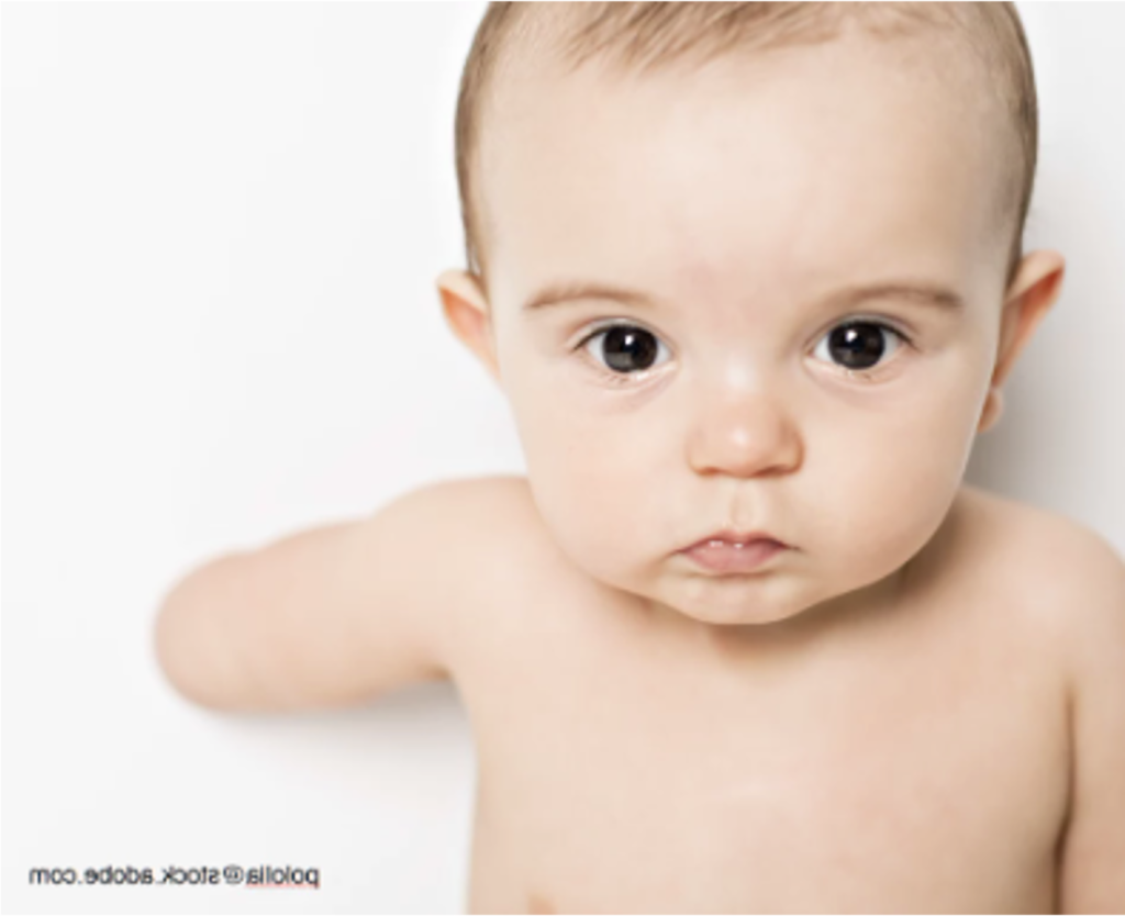 TEMP- Image of a child born with Absent Limb