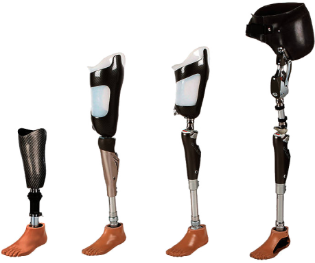 Example of Lower Limb Prosthesis